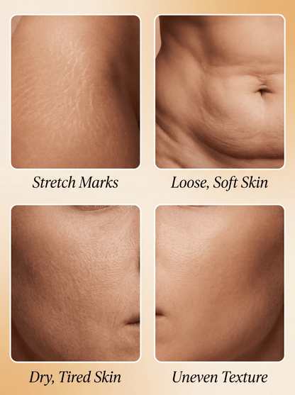 Lifetrack Golden Hour- Fact acting Cellulite Thermo firming Gel